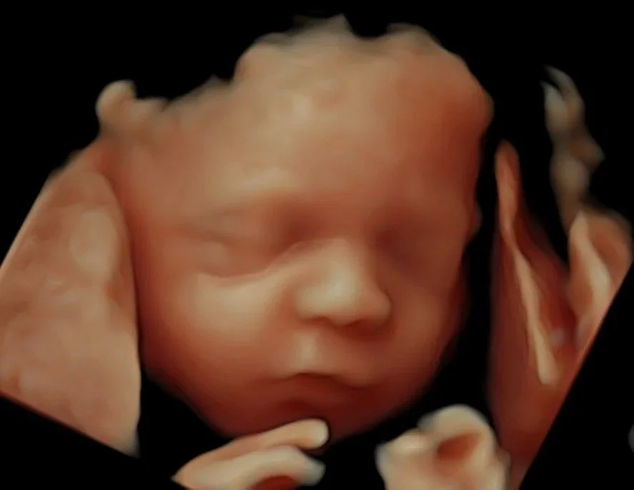 5d-ultrasound-baby-image