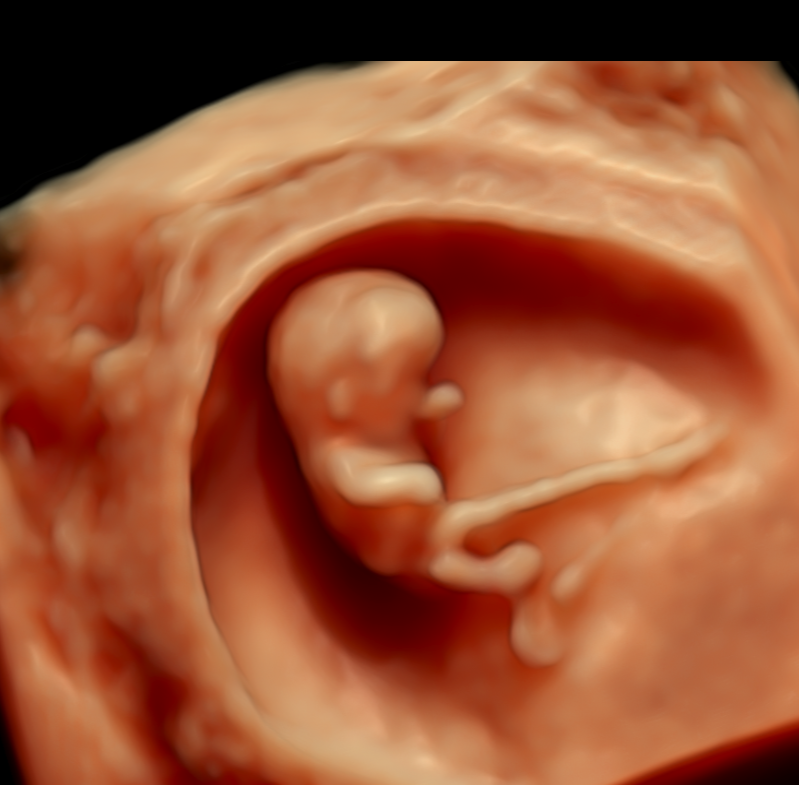 5d-private-ultrasound-image
