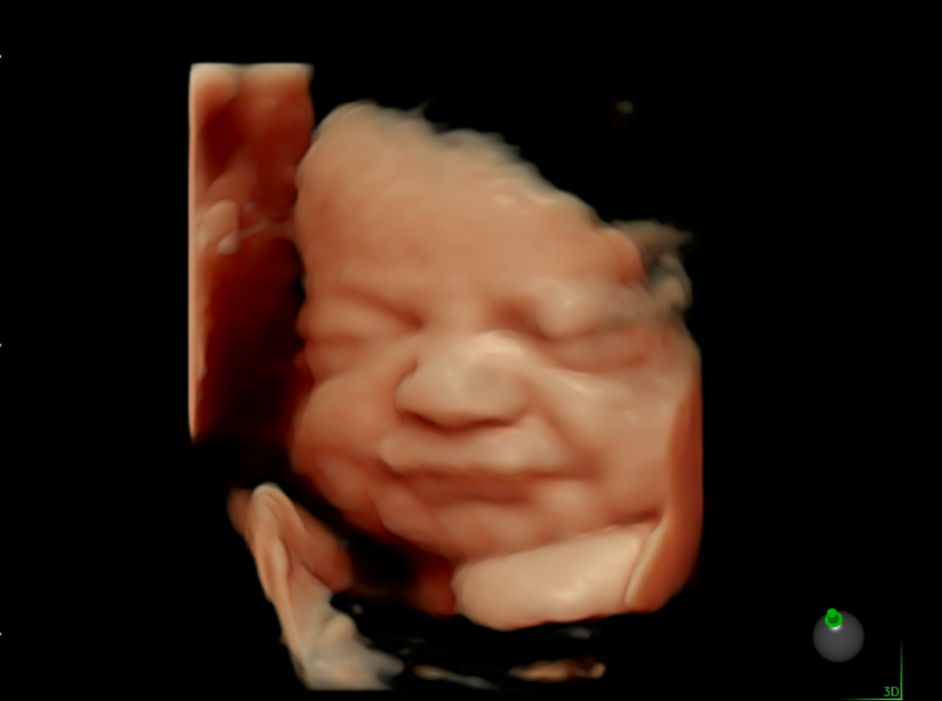 %23Ultrasound_1.png