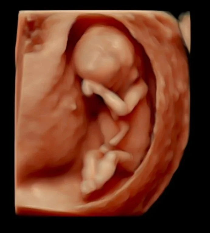 baby-5d-scan.jpg