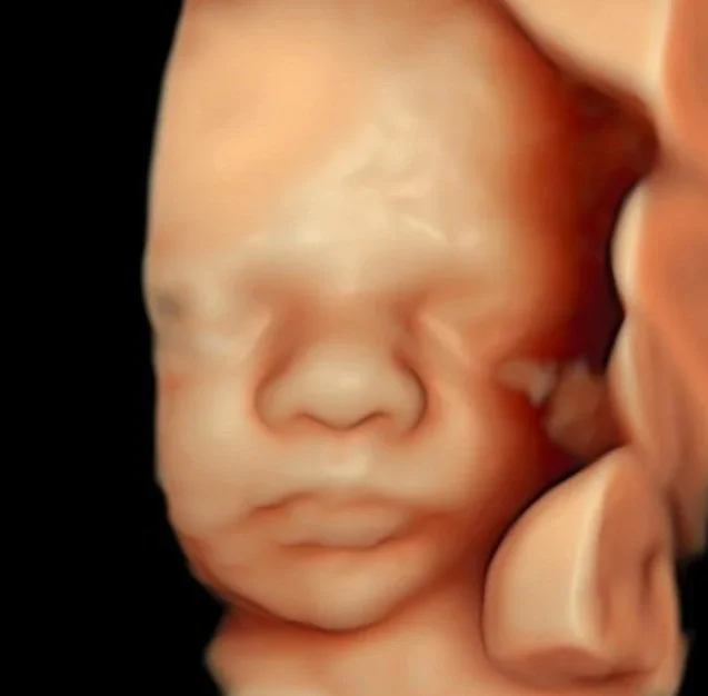 4d-baby-image.jpg