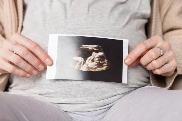 Keepsake 3D/4D Ultrasound Perth: Capturing Precious Moments