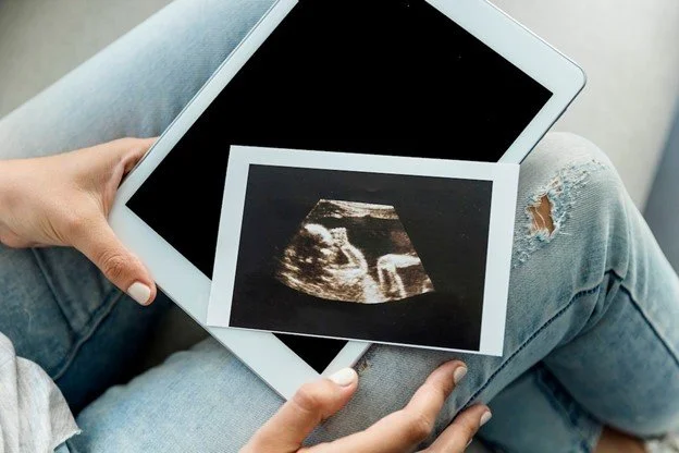 4D Baby Scan Perth: When Is the Best Time to Book?