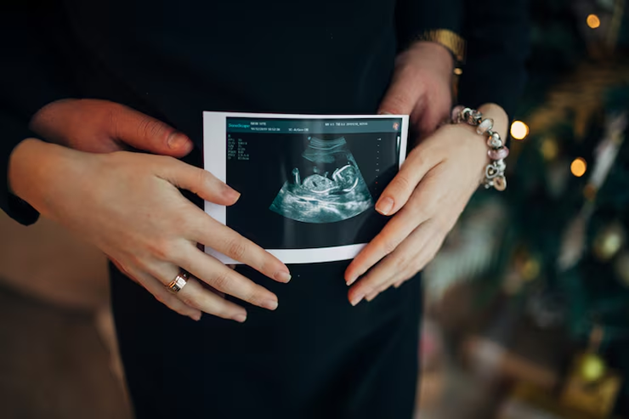 Affordable 4D Baby Ultrasounds in Perth Without Compromising Quality