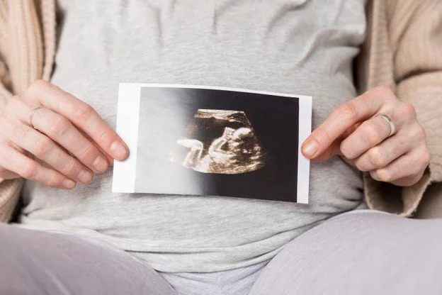 How to Prepare for Your First 3D/4D Baby Ultrasound in Perth