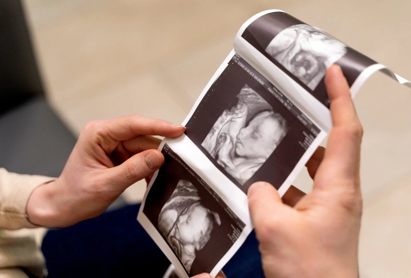 T3D Baby Scan Preparation: Small Things That Can Make Your Appointment More Enjoyable