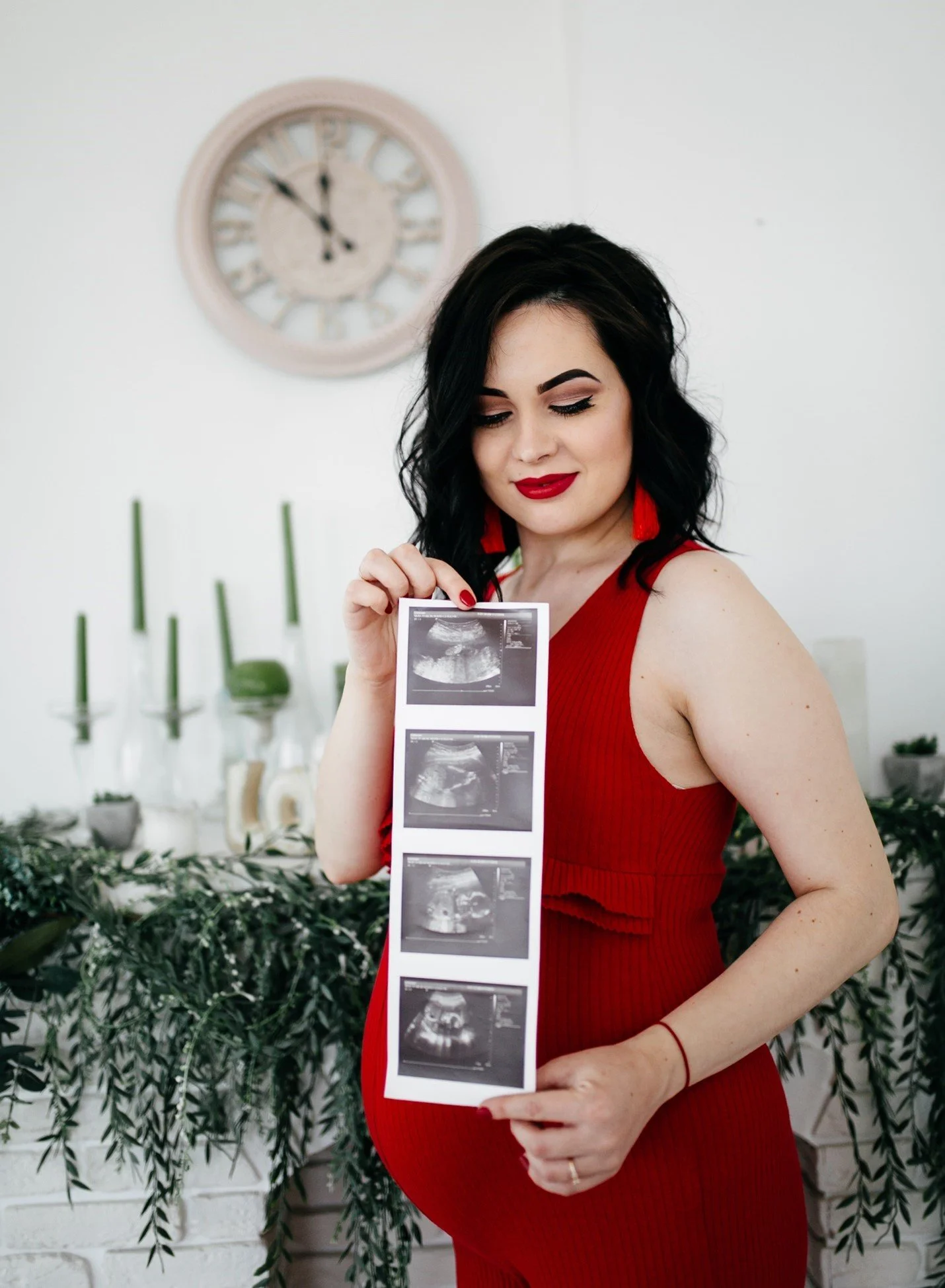 3D/4D images Ultrasound Perth