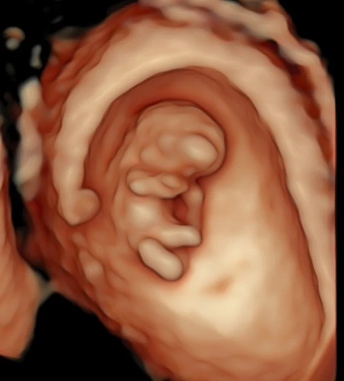 3d-4d-baby-ultrasound-image