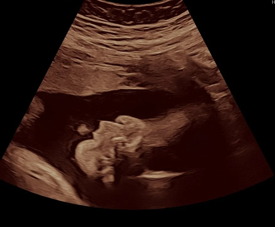 2d-ultrasound-image