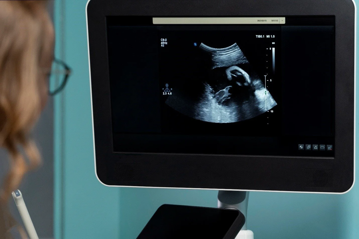 5D baby scan Perth