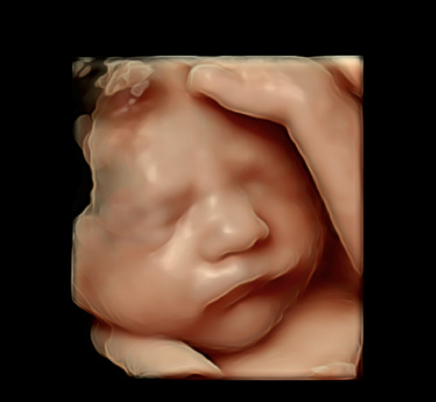 amara-imaging-3d-ultrasound-perth.png