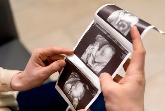 4D baby scan Perth