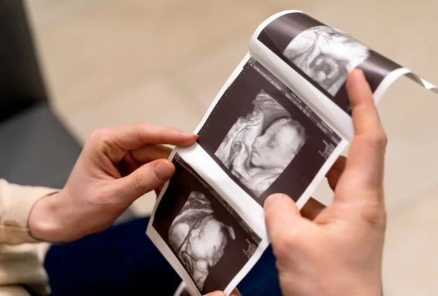 Baby scan image Perth