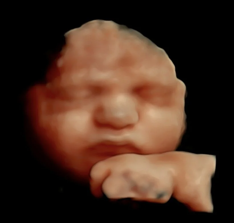 amara-imaging-5d-ultrasound.jpg