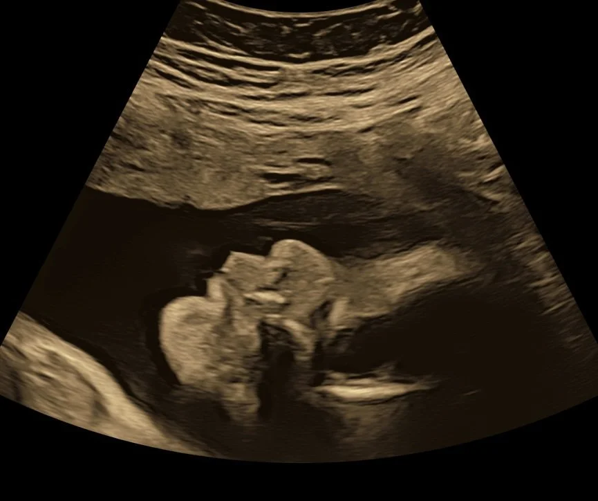 2d-image-of-baby