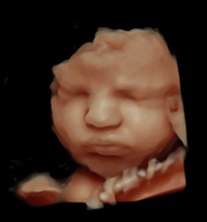 3d-baby-image.jpg