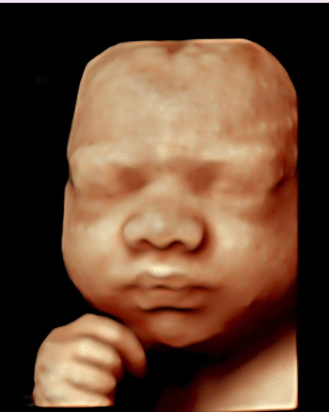 Pregnancy Ultrasound Perth | HD 5D Pregnancy Ultrasound Perth
