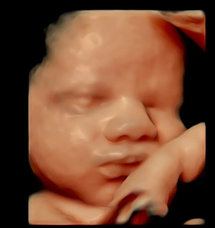 3d-4d-ultrasound-perth.jpeg