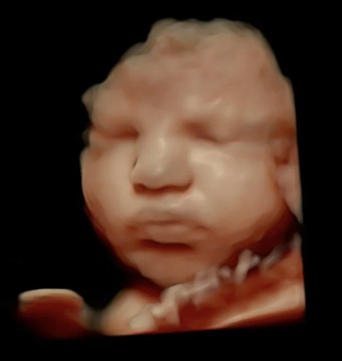 5d-ultrasound-perth-amara-imaging.jpg