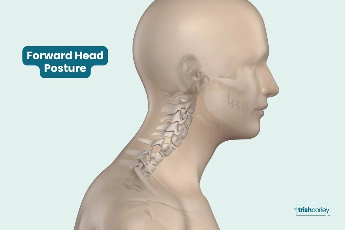 Anatomy graphic showing forward head posture and its effect on cervical spine alignment in yoga