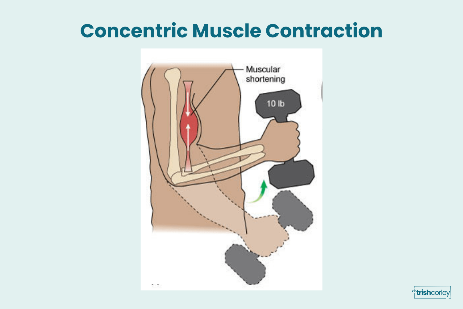 Concentric muscle contraction showing biceps shortening