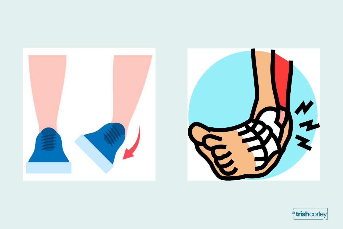 Illustration of an ankle rolling showing how a ligament sprain occurs