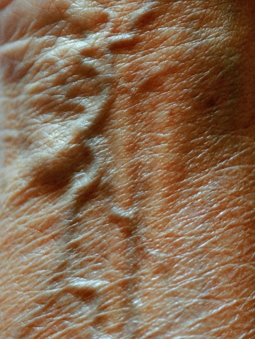 Signe Luksengard&rsquo;s photographic series Diafragma explores the body as a site of memory, transformation, and resilience.

Centred around breath, rhythm, and internal movement, the photographs draw attention to the unseen processes that shape our