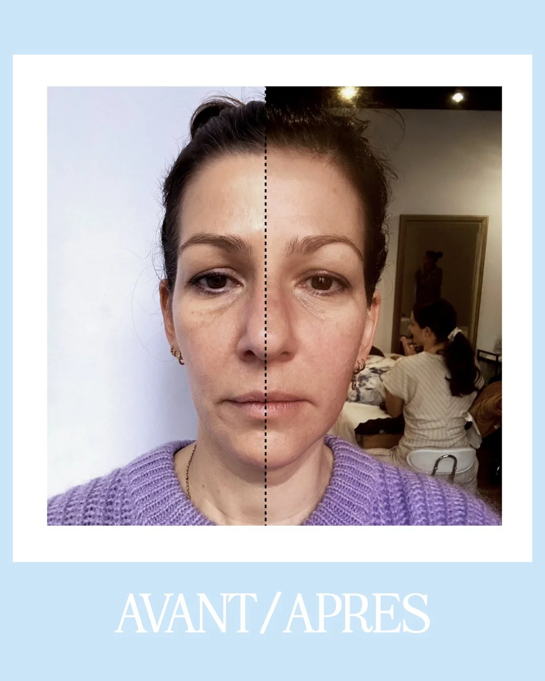 Sculptural Face Lifting® le massage qui sculpte votre jeunesse