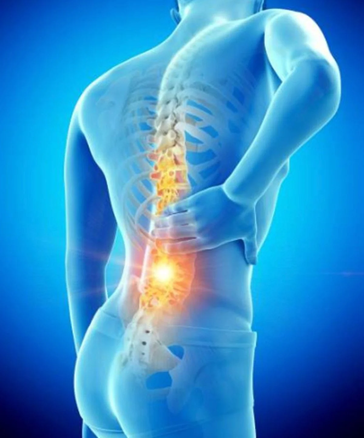Digital illustration of a human figure showing the spine and lower back with emphasis on the lumbar region, radiating light indicating pain or injury.