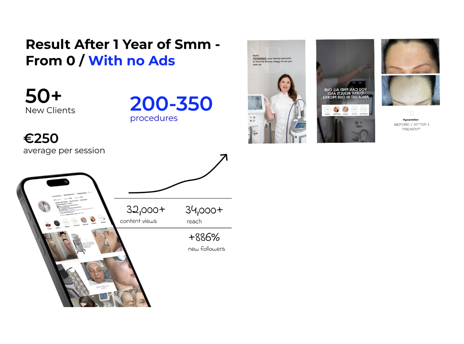 Aesthetic Practitioner Social Media Marketing | Instagram Content & Reels  Beauty Aesthetic Marketing Case Study | Instagram Content Creation  Social Media Marketing for Aesthetic Services | Instagram Growth