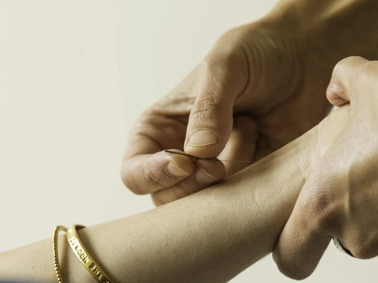 quinn-taplin-hand-detail-accupuncture-closeup.jpg