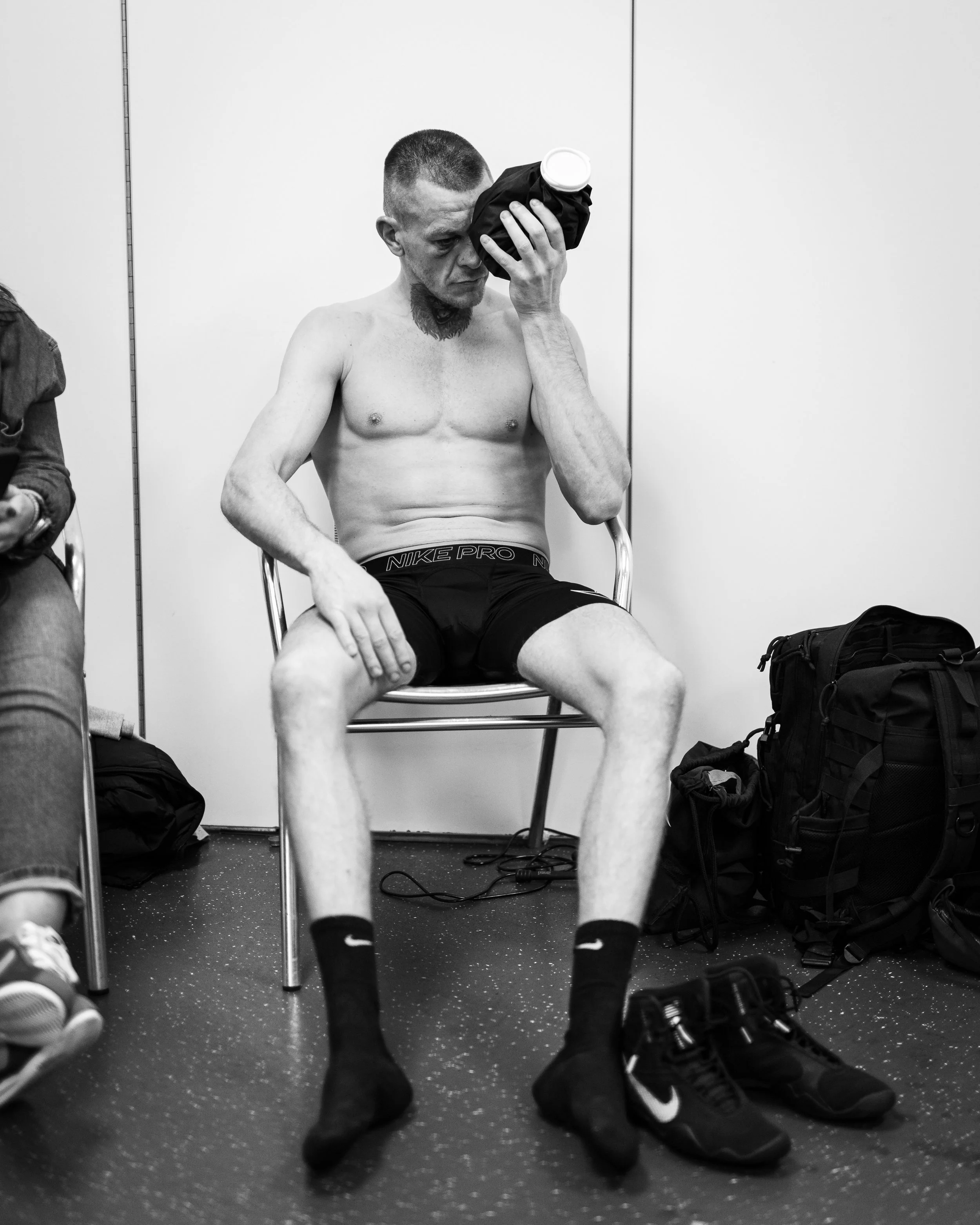 Gavin Gwynne ices his eye after his shock defeat against Cameron Vuong in Birmingham for Matchroom