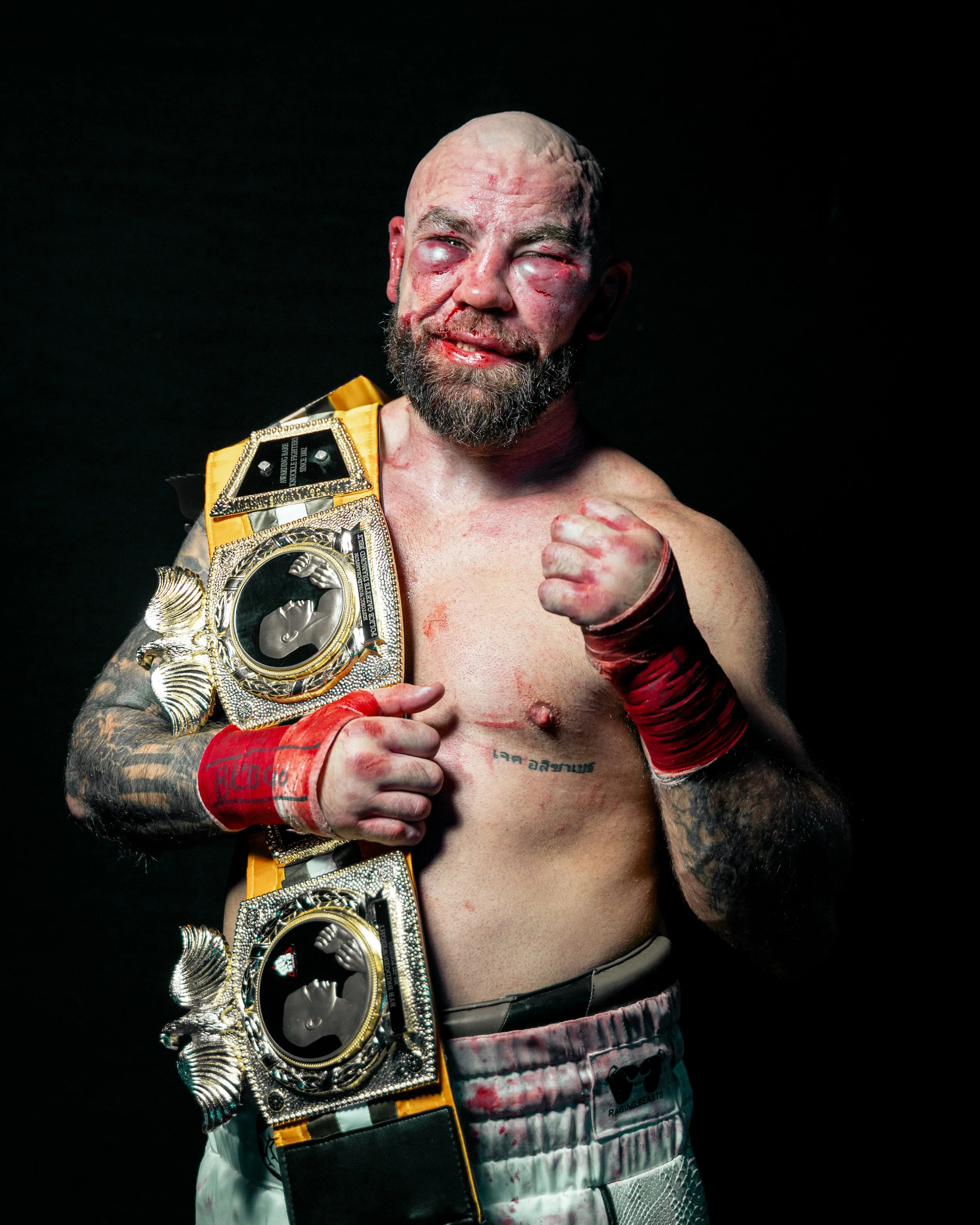 Boxer with championship belt, red hand wraps, and a beard, posing shirtless against a dark background.