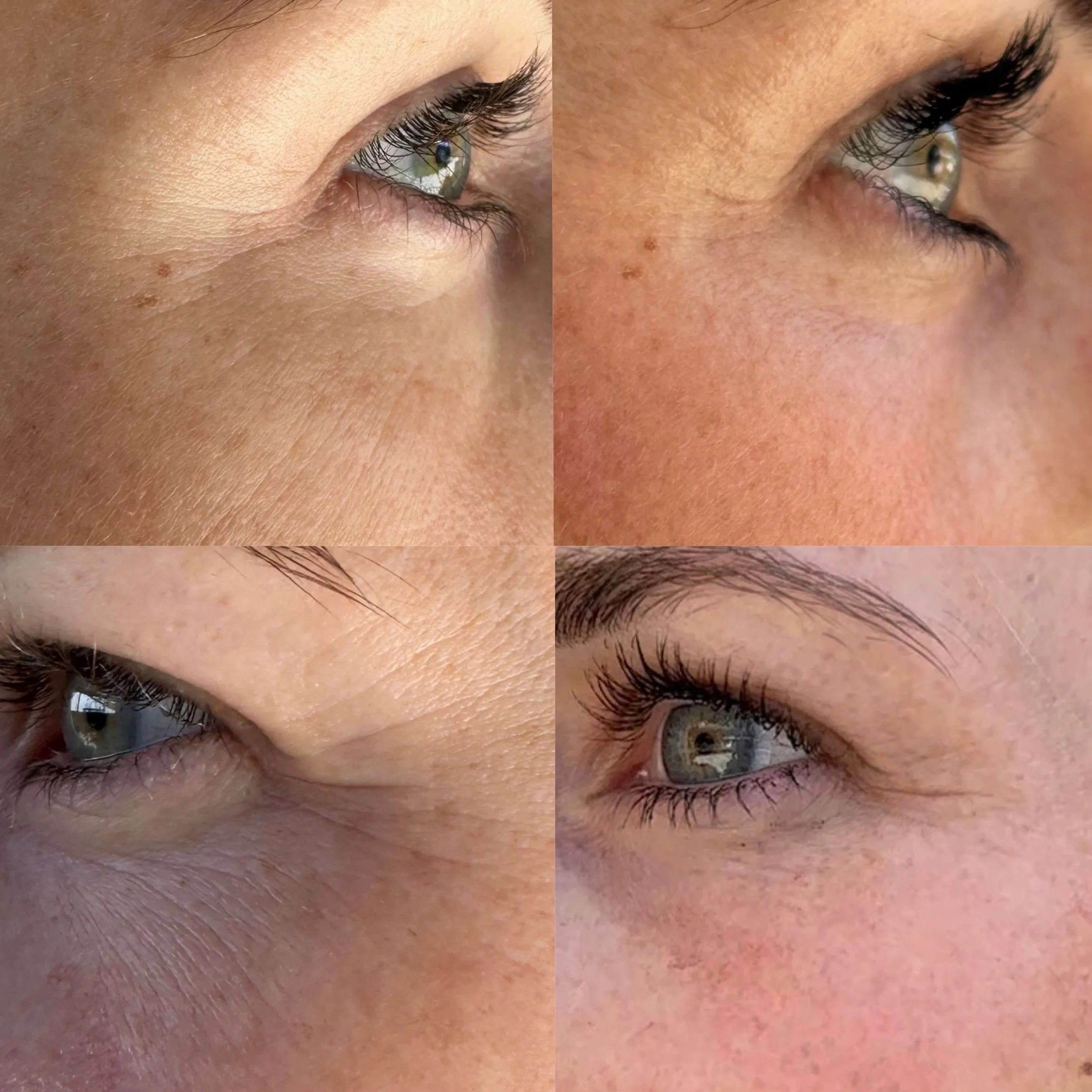 natural-skin-treatments.JPG