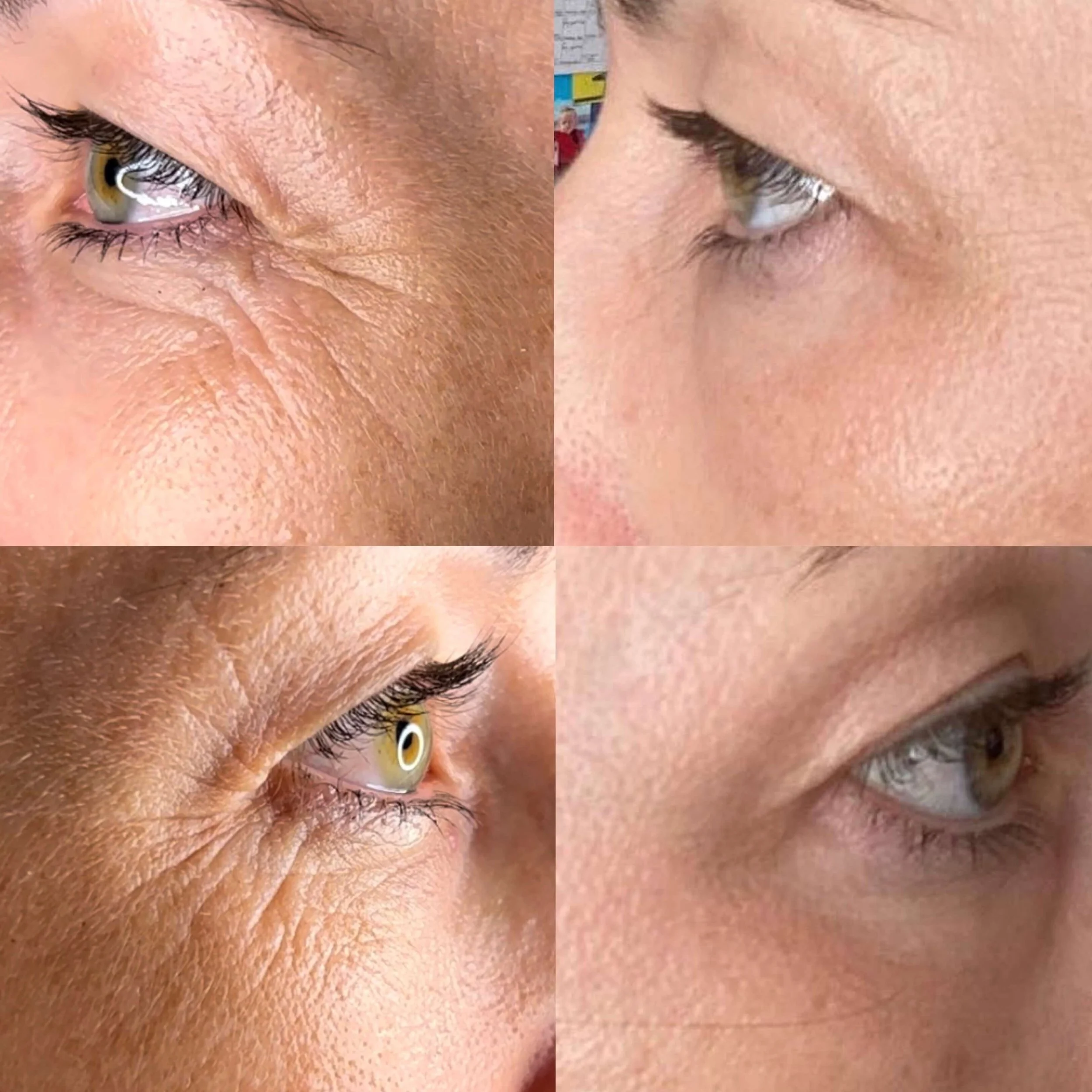 skin-treatments-goldcoast.JPG