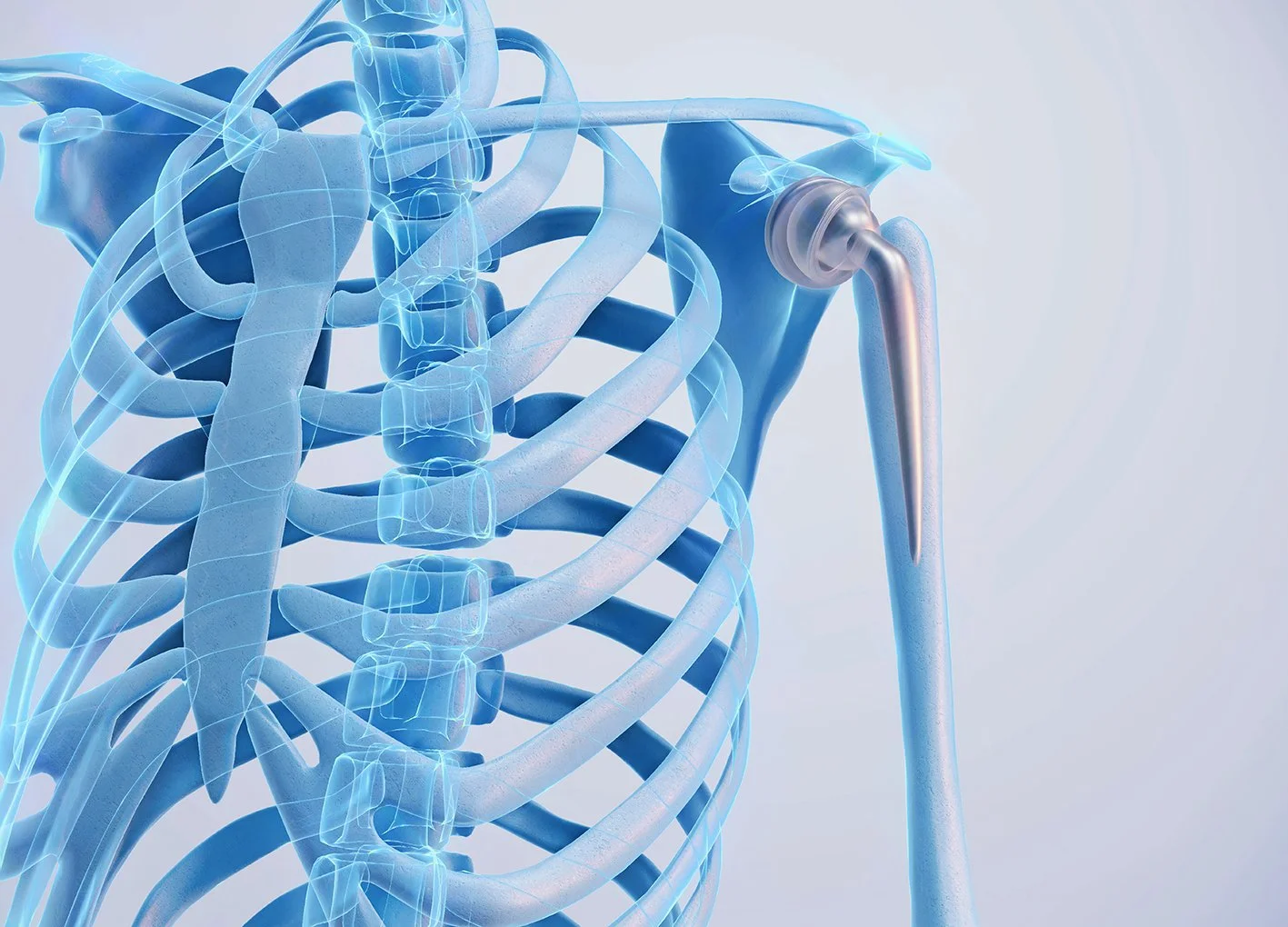 Shoulder Replacement Surgery Warrnambool Dr Nathan Kirzner