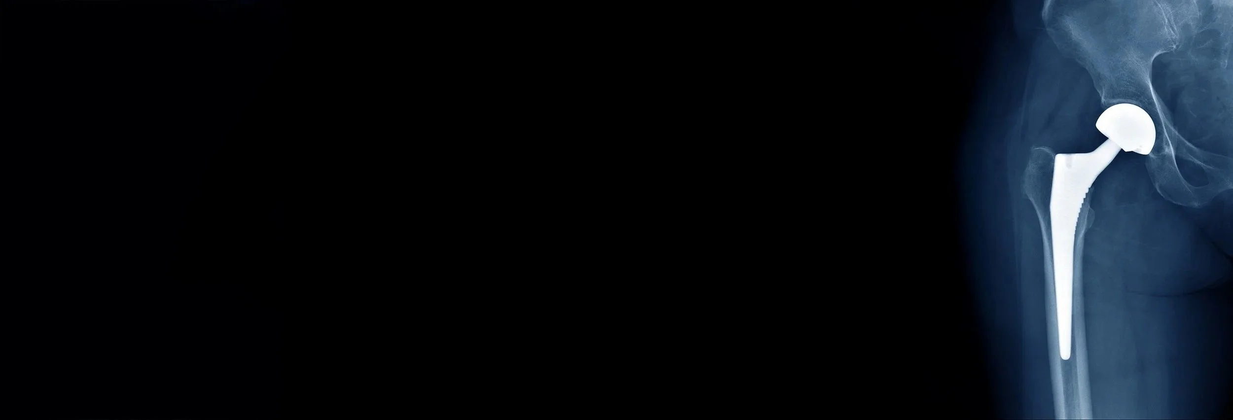 Hip Surgery Warrnambool Dr Nathan Kirzner