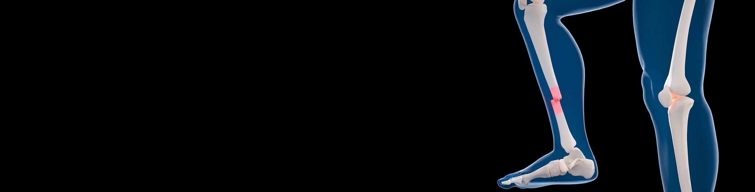 trauma Surgery  Warrnambool Dr Nathan Kirzner