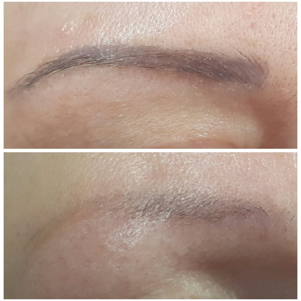 Permanent Make Up Saline Removal