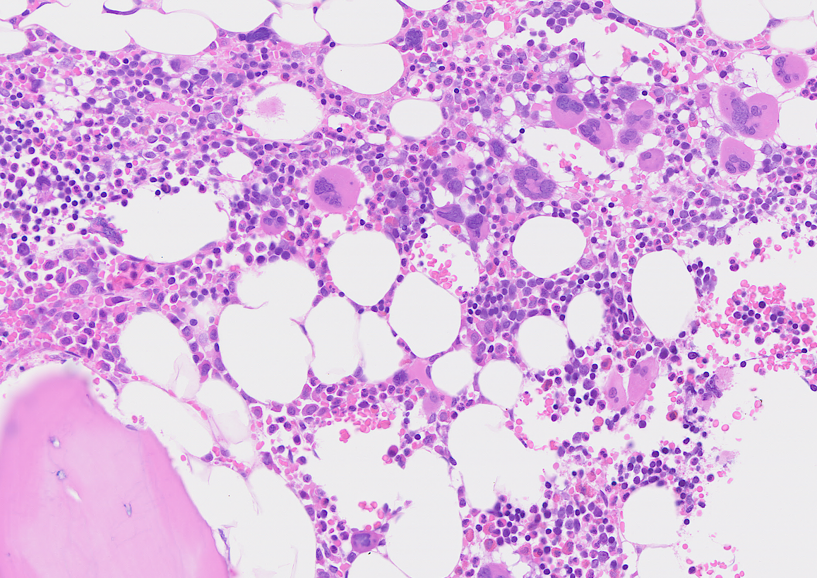 Microscopic view of bone marrow showing various blood cells and adipocytes.