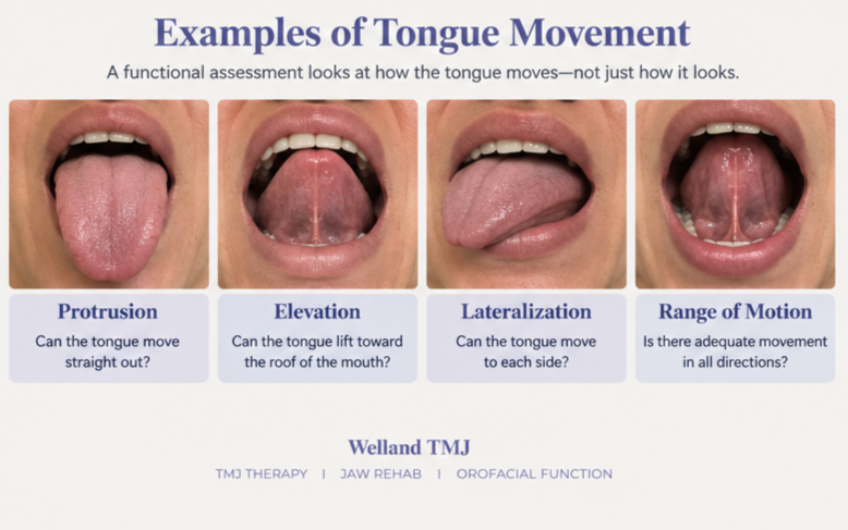 Examples of tongue protrusion, elevation and lateral movement assessed during a functional tongue and TMJ evaluation.