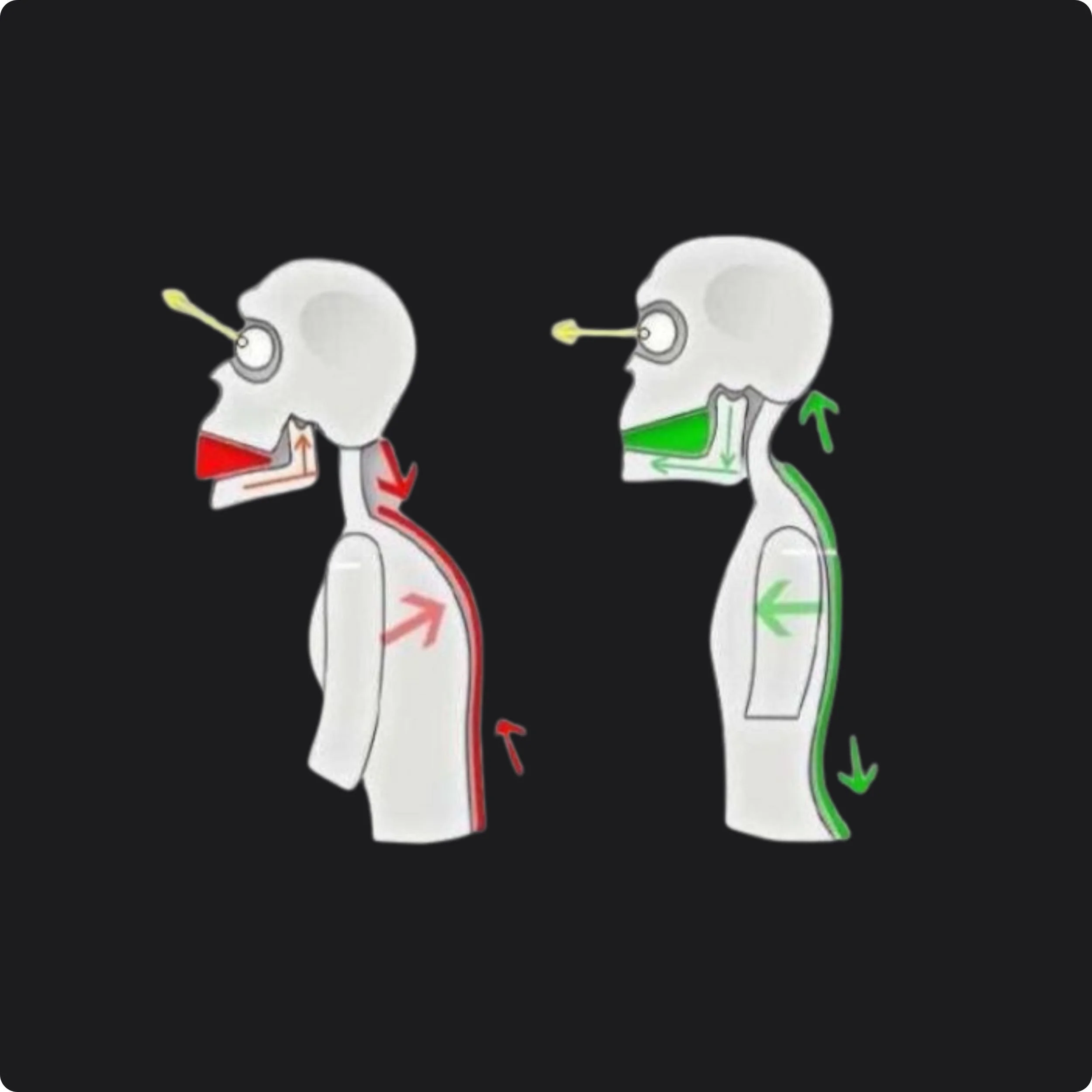 image of two figures with good posture and poor posture