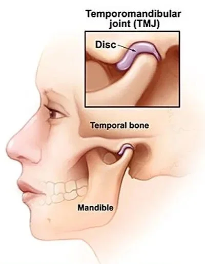Jaw clicking and TMJ disc movement