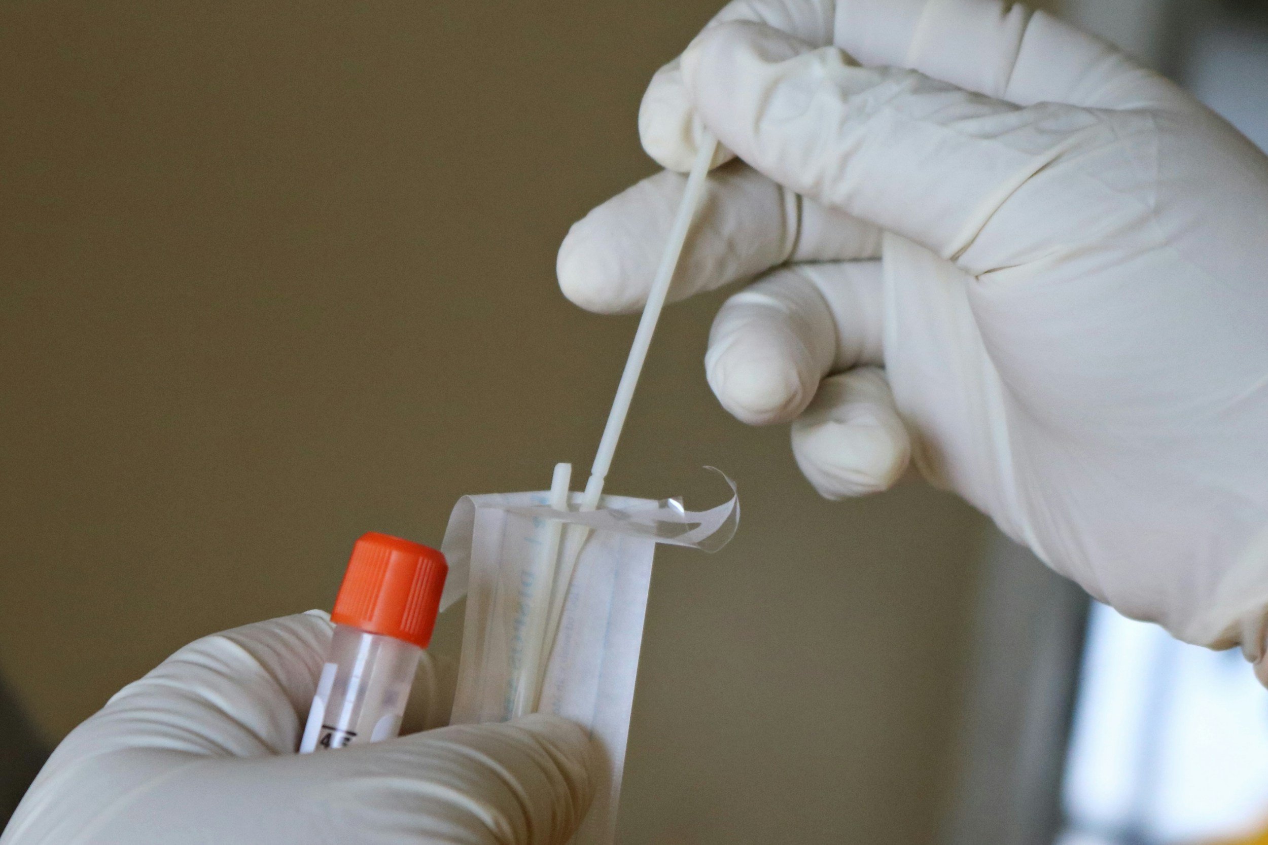 Why We Use Organic Acids Testing (OAT) for Children on the Autism Spectrum