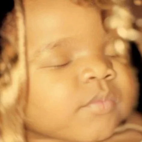 8k Render of 3D ultrasound image