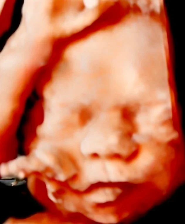 8K RENDER OF 3D ULTRASOUND