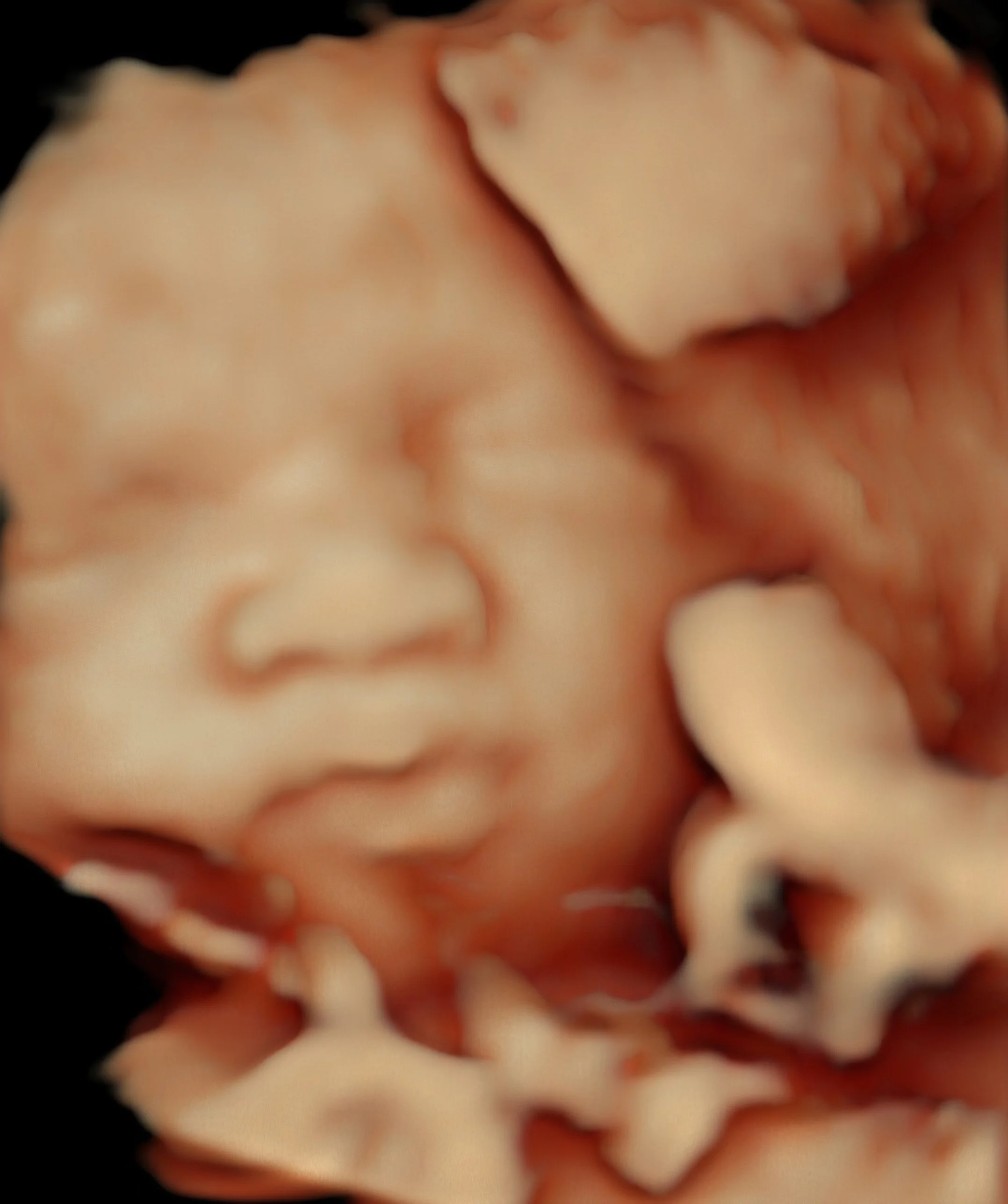 HDlive ultrasound image showing detailed baby features 3d 4d tampa