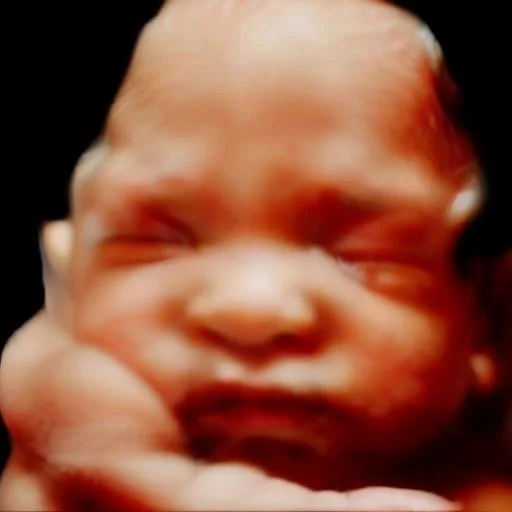 8k transformation of 3d4dhd ultrasound