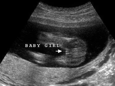 Ultrasound gender reveal session for expecting parents in Tampa