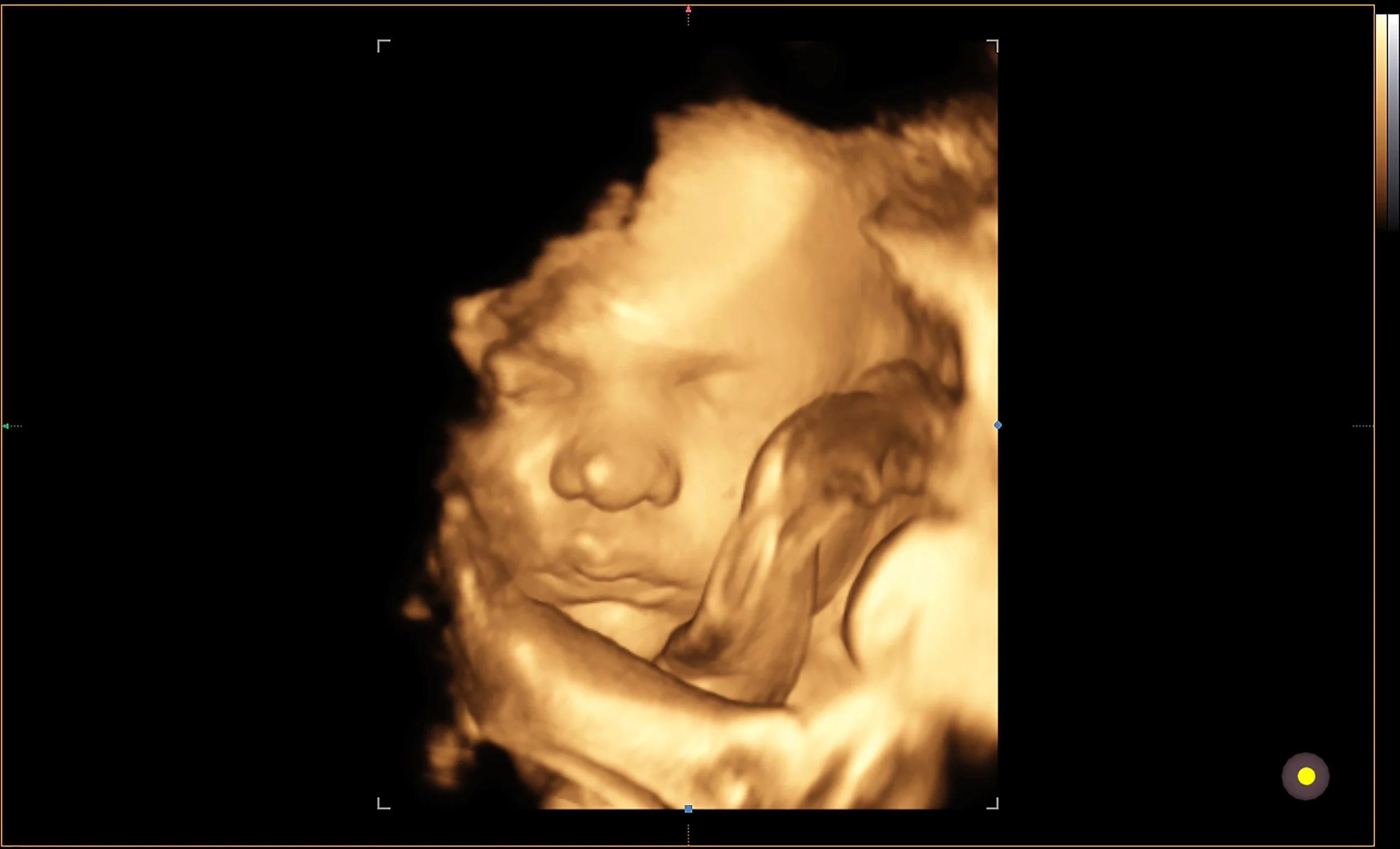 4D ultrasound image showing baby moving in real time during session